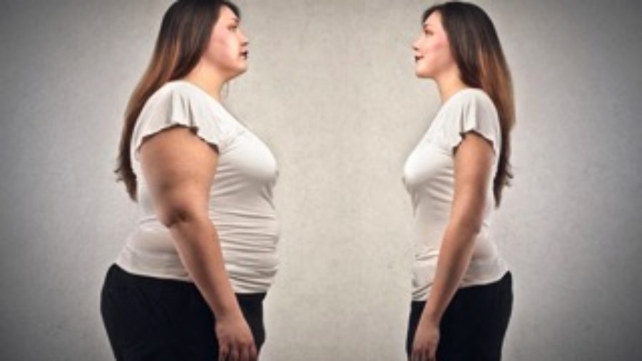 Obesity Before And After - charlotte hormone imbalance treatment