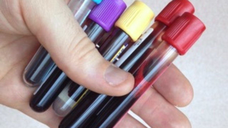 Vials of Blood - diabetes testing in charlotte