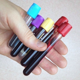 Why lab testing is important in functional medicine