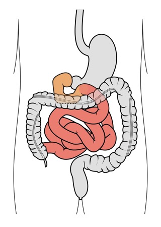 Digestive Tract - food sensitivity testing in charlotte