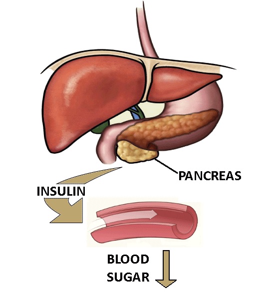 Pancreas, Insulin, Blood Sugar - charlotte autoimmune disorder treatment