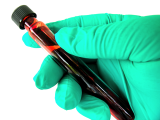 Blood Vial - infection testing in charlotte