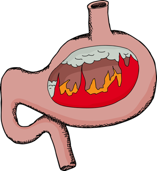 Fire In a Stomach - charlotte inflammation treatment